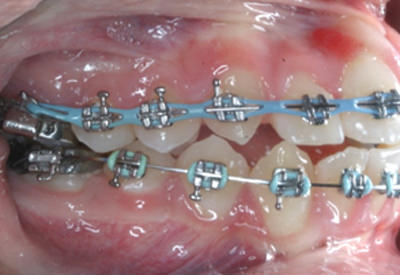 Fig.15 Foto lateral derecha