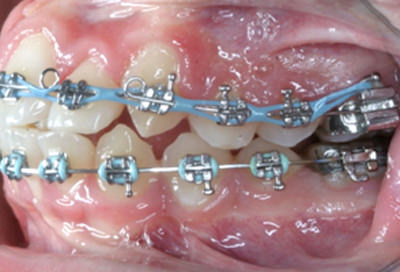 Fig. 16 Foto lateral izquierda