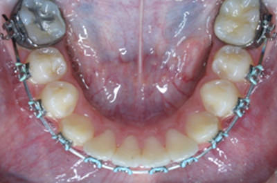 Fig 18 Oclusal inferior