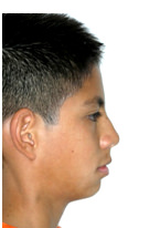 Figura 20 Perfil