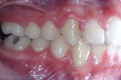 Fig.23 Foto Lateral Derecha