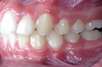 Fig.24 Foto Lateral Izquierda