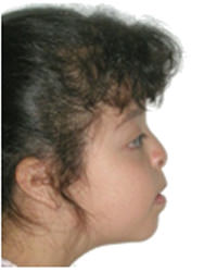 Figura 2 Paciente de Perfil
