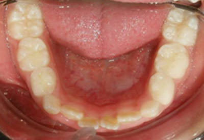 Figura 7 Oclusal inferior