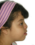 Figura 12 Paciente de Perfil