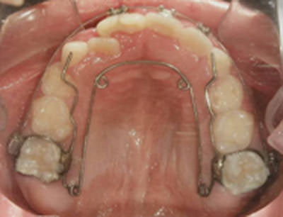 Figura 13 Oclusal superior