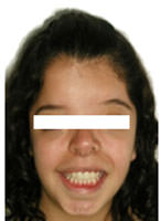 Figura 18 Sonrisa