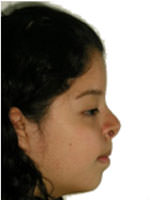 Figura 19 Perfil del paciente