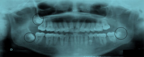 Figura 24 Radiografía panorámica