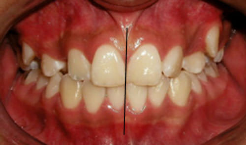 Figura 4 Foto intraoral de frente