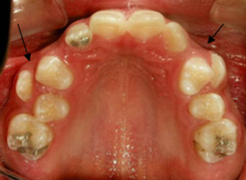 Figura 7 Oclusal superior
