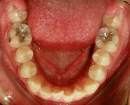 Figura 8 Oclusal inferior