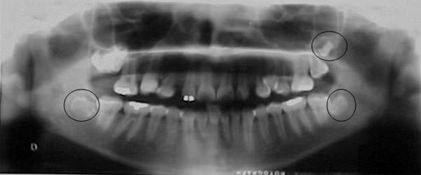Fig 10 Radiografía Panorámica