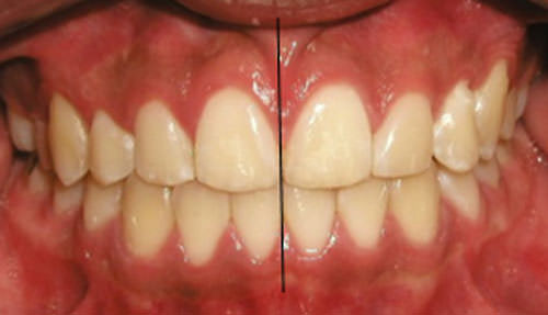 Fig. 18 Intraoral de frente