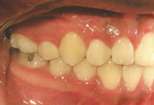 Fig.19 a lateral derecha