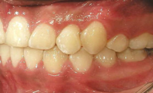 Fig.19 b Lateral izquierda