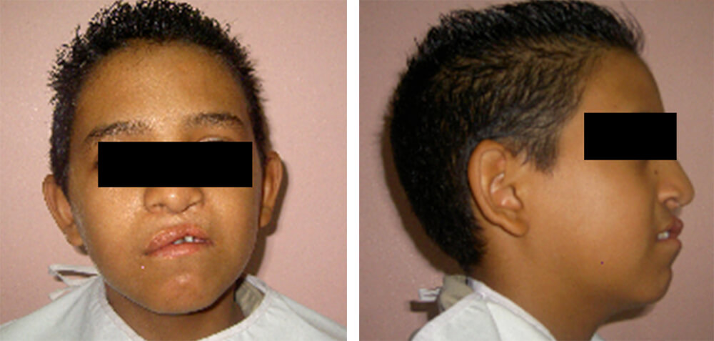 Foto 1. Paciente de frente / Foto 2. Paciente de perfil