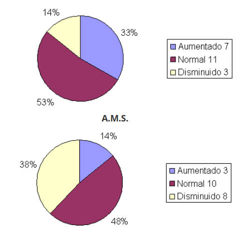 Grafico Nº 5: Distribución de la muestra obtenida del ancho intercanino e intermolar del maxilar en pacientes masculinos por edades. A.I.S.