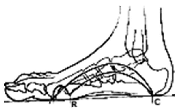 Fig. 13 Zonas de apoyo normal. Tomada Moreno de la Fuente J. Podología general y Biomecánica, Edit. MASSON 2.003,1ª edición.