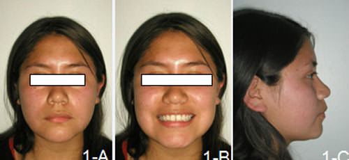 Figura 1-A frente, 1- B frente sonrisa, 1-C perfil.
