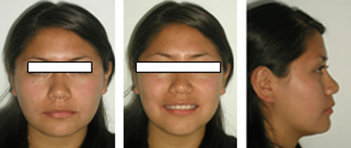 Figura 10-A Fotografías frente, 10- B frente sonrisa, 10- C perfil.