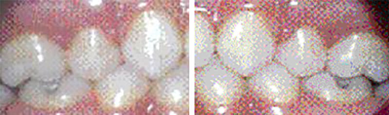 Figura 5