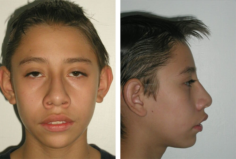 Figura 1 Frente inicio / Figura 2 Perfil