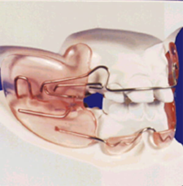 Figura 8 Aparato de Frankell II
