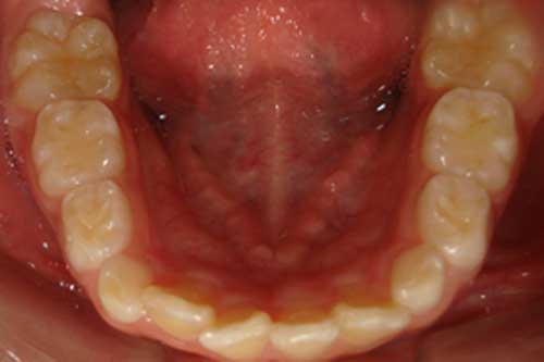 Figura 4