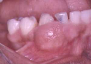 Fig.1