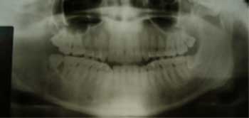 Fig.2