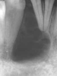 Fig.2