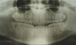 Fig. 12