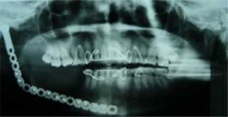 Fig. 20