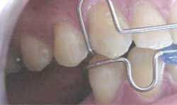 Fig. 29
