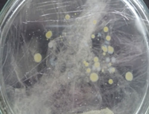 Figura 4 Caja de Petri con cepas bacterianas en color crema y blanco a los 15 días ORMCO