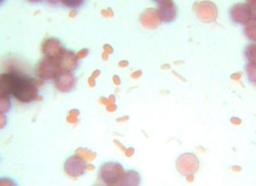 Figura 5 Levaduras y hongo con micelio (Candida s.p.) a los 30 días 100 X LANCER;
