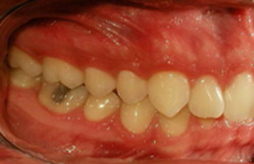 Figura 4 Lado derecho