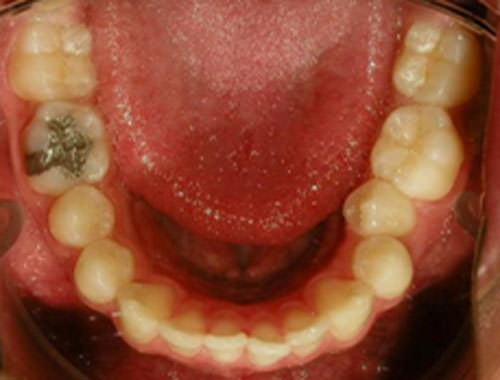 Figura 7 Oclusal inferior