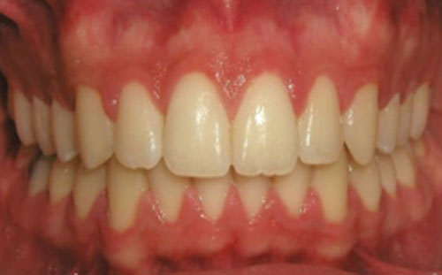 Figura 20 Intraoral de frente