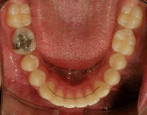 Figura 24 Oclusal Inferior