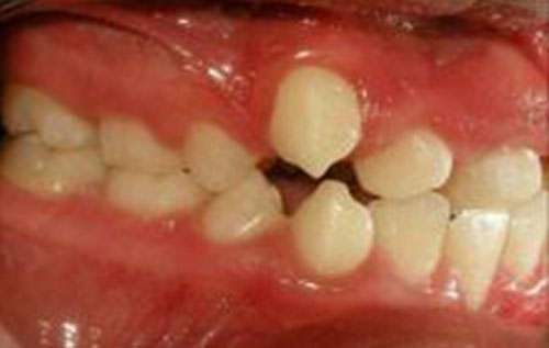 Fig 5 Foto lateral derecha