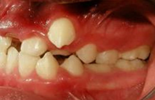 Fig 6 Foto lateral izquierda
