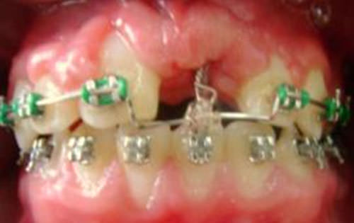 Figura 11 Intraoral de frente