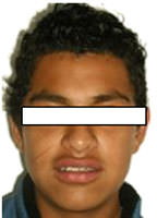 Figura 13 Extraoral de Sonrisa