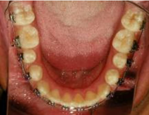 Figura 15 Oclusal Inferior