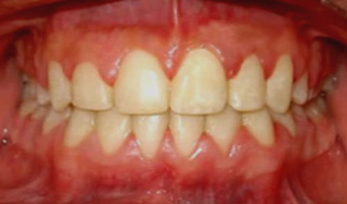 Fig. 19 Intraoral de frente