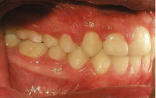 Fig.20 Foto lateral derecha