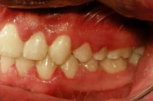 Fig.21 Foto lateral izquierda