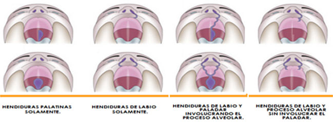 Figura 2